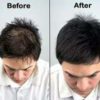 Shampooing pour la croissance des cheveux Pour Homme et Femme