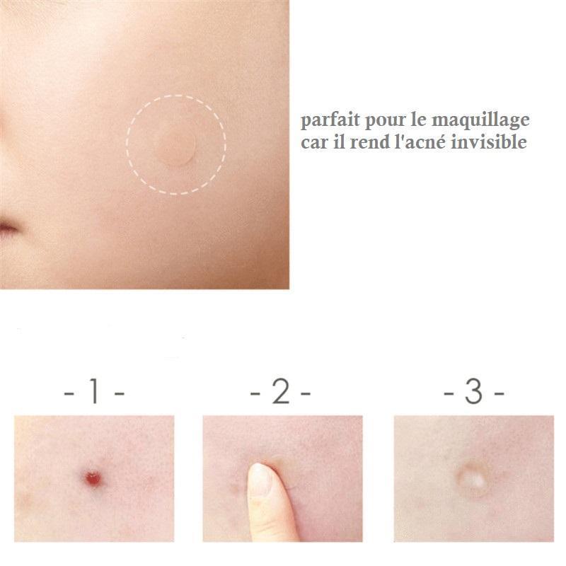 Patchs anti-acné magiques ( 24 pièces )