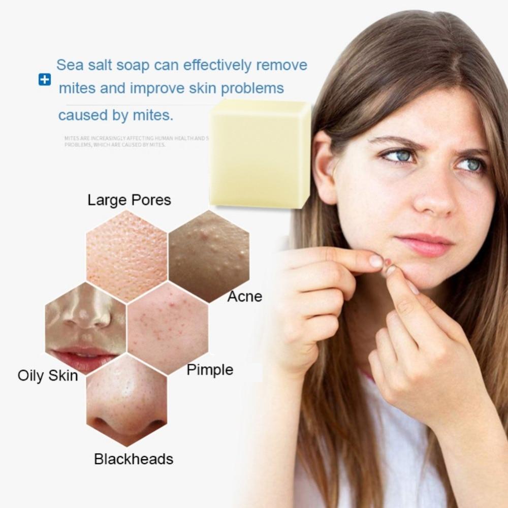 Savon Anti-acné Magique
